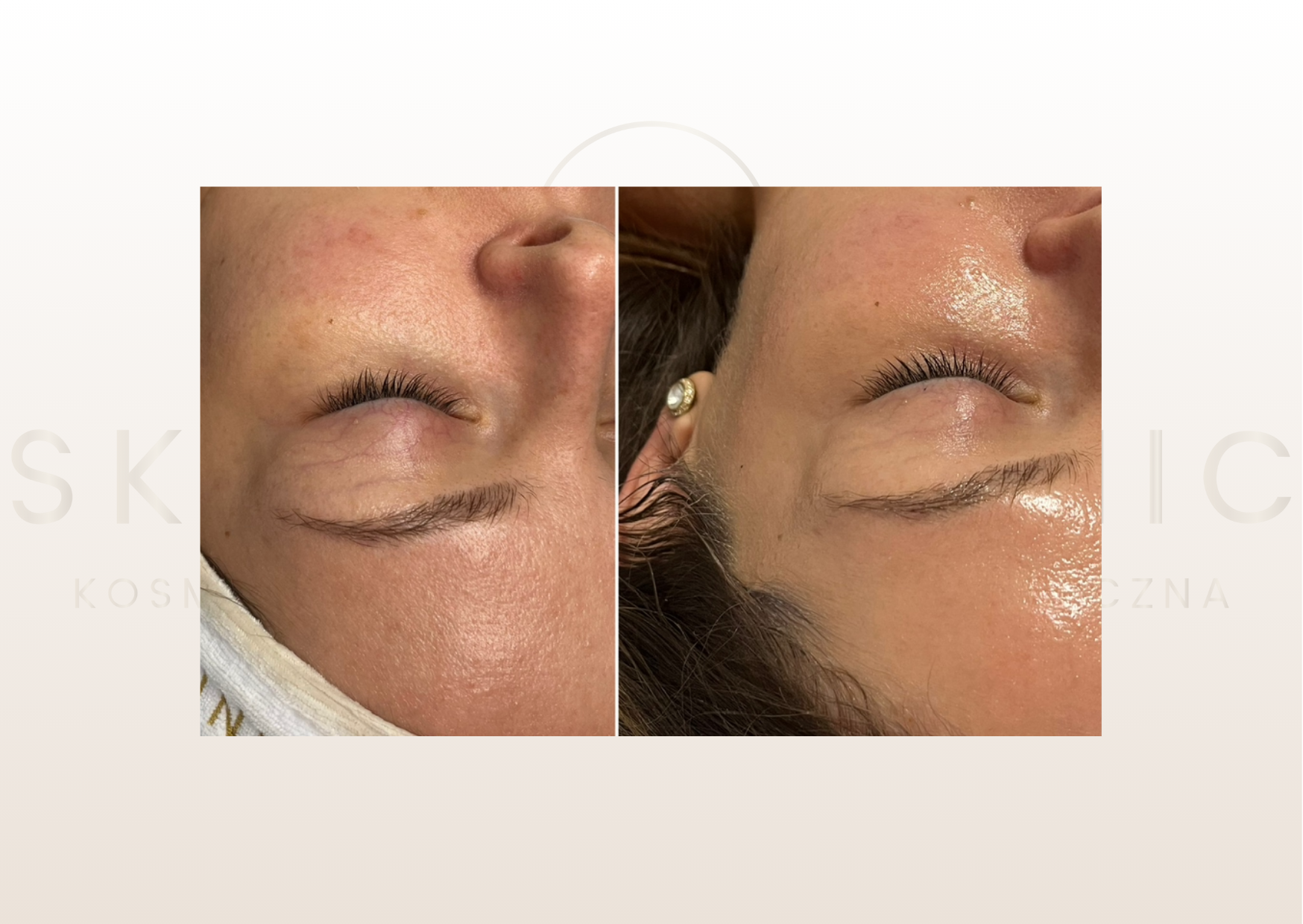 Rozświetlenie / nawilżenie skóry