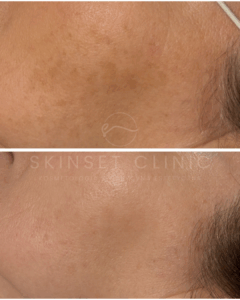 Efekty przed i po (3)